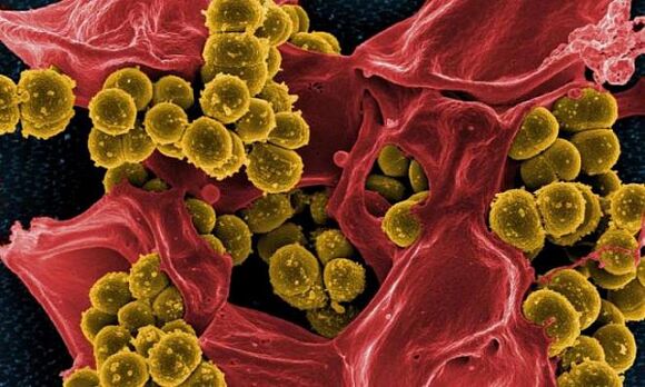 Staphylococcus aureus kaip bakterinio prostatito priežastis